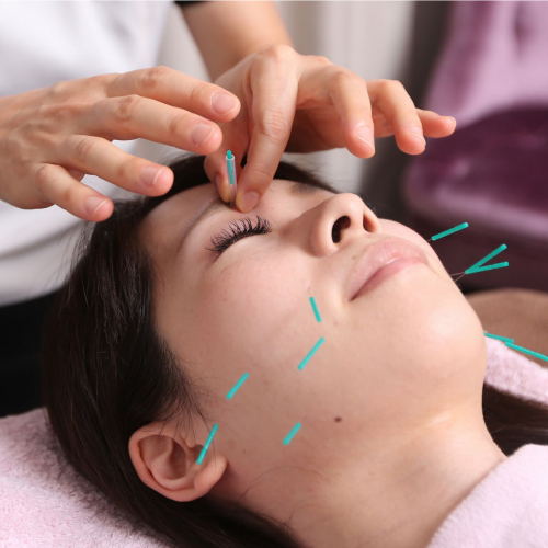 ☆美容鍼コース