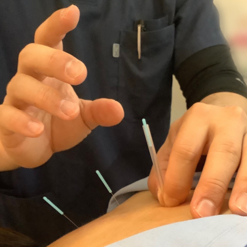 継続治療の方・鍼