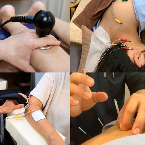 オーダーメイド鍼コース（ショート）